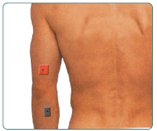 गोल्फर-बांह TENS