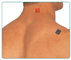 रीढ़ की हड्डी में दर्द TENS