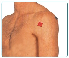 कंधे के दर्द TENS