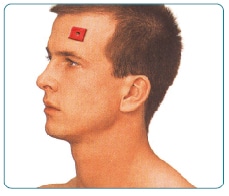 तनाव सिर दर्द TENS