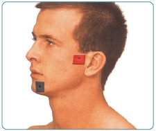 चेहरे का दर्द TENS